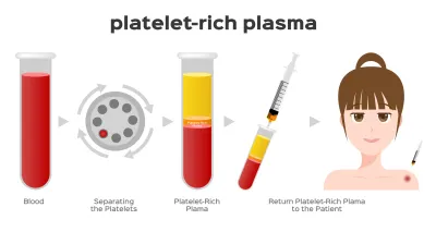 PRP Nedir? Cilt ve Saç Güzelliği İçin Platelet Zengin Plazma Tedavisinin Tam İncelemesi