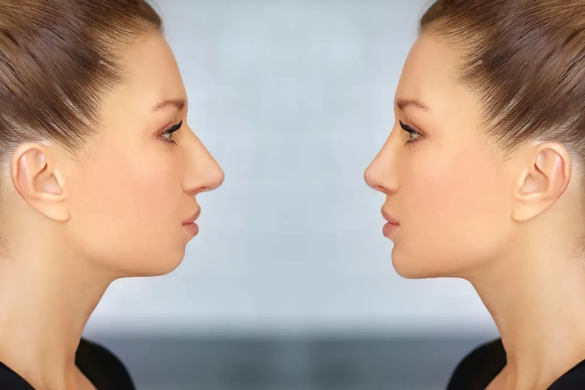 ئەنجامی کۆتایی و ڕۆڵی پزیشکی پسپۆڕی نەشتەرگەری لە نەشتەرگەری چەناگە و ڕوومەت