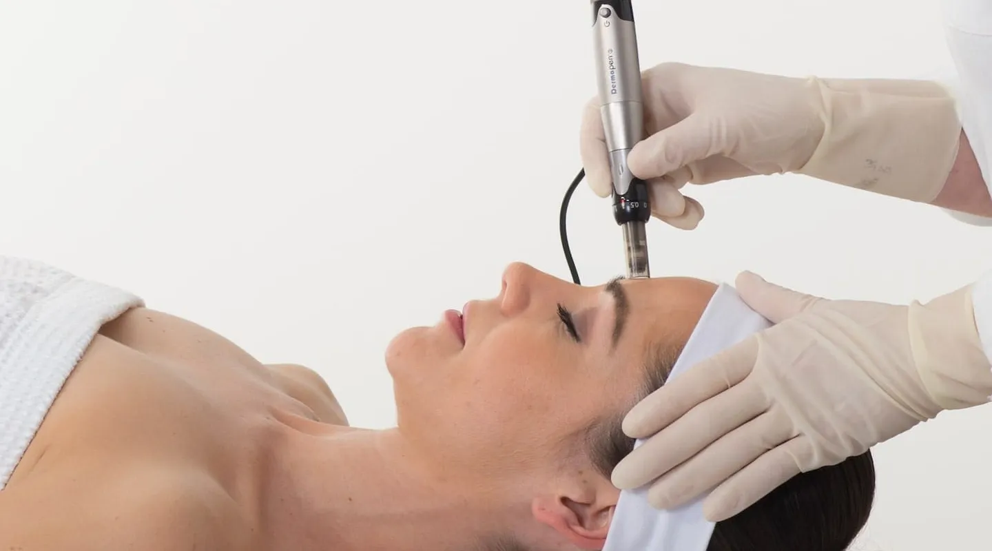 Potential side effects of microneedling and Dermapen