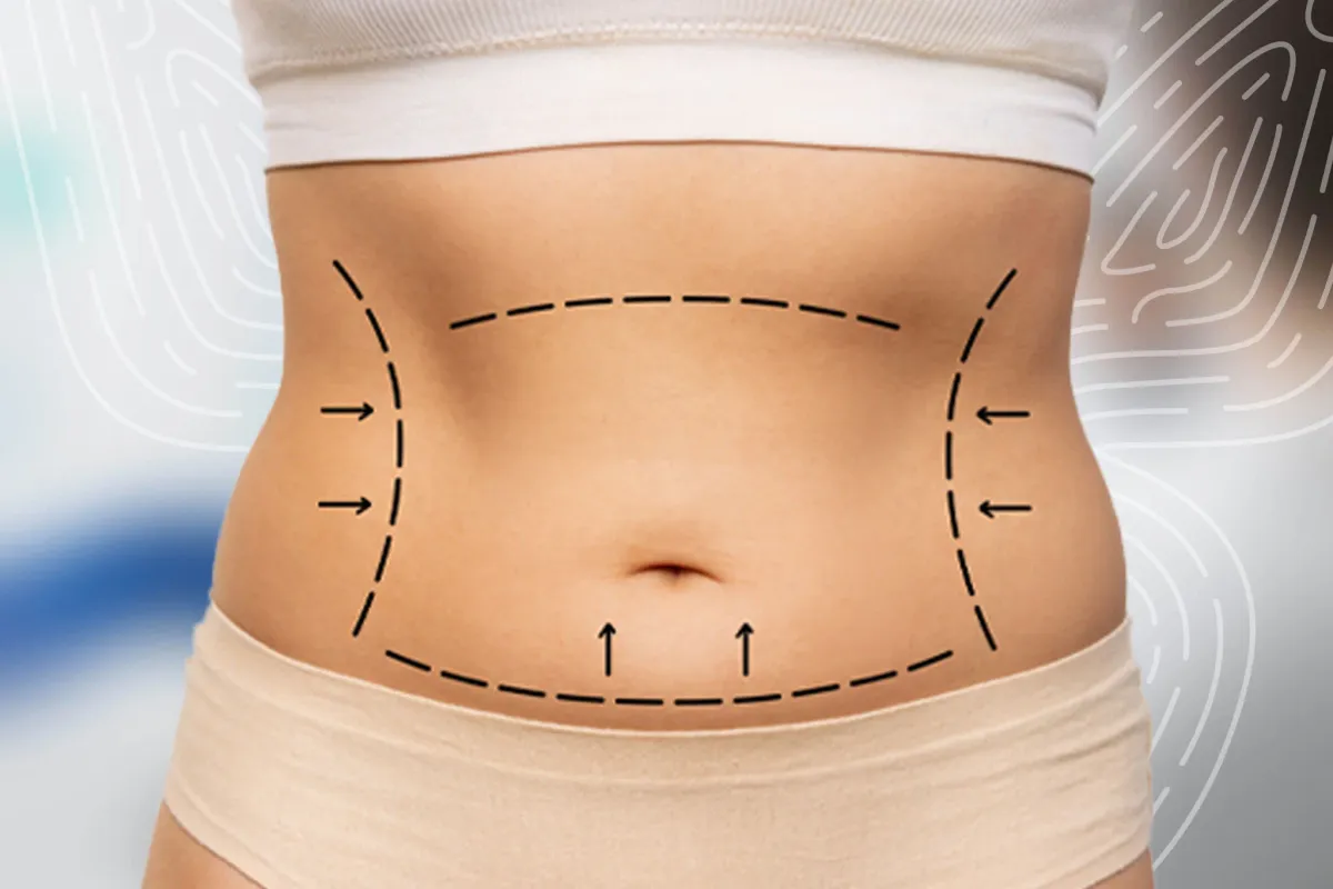 腹部和侧腰手术益处及预期效果