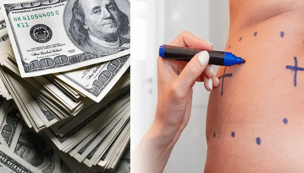 腹部和侧腰手术费用及全球影响因素