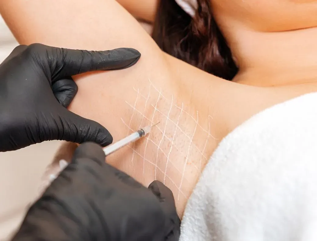 Terleme botoksu nedir?