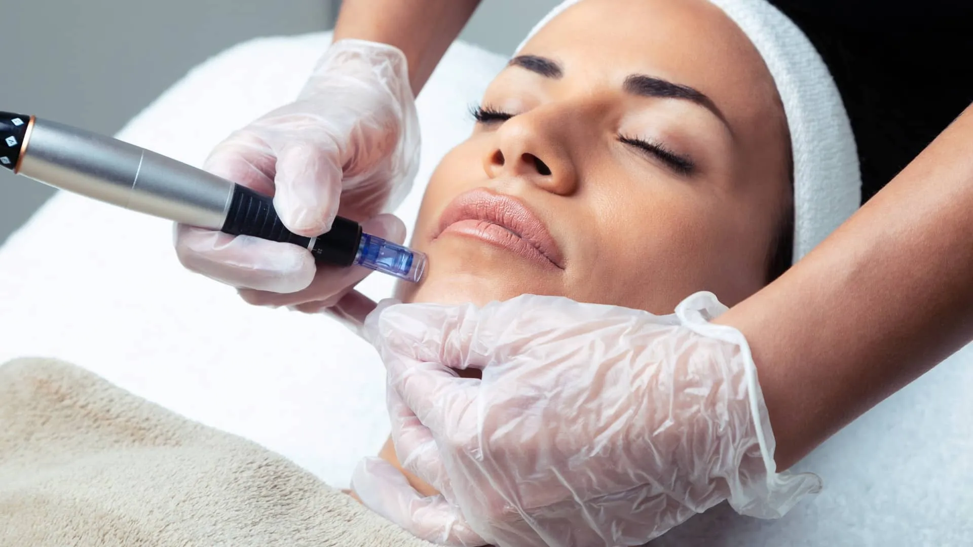Main applications of microneedling