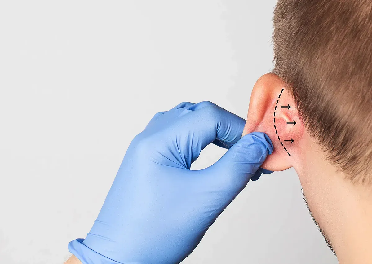 Pre- and Post-Operative Ear Surgery Care