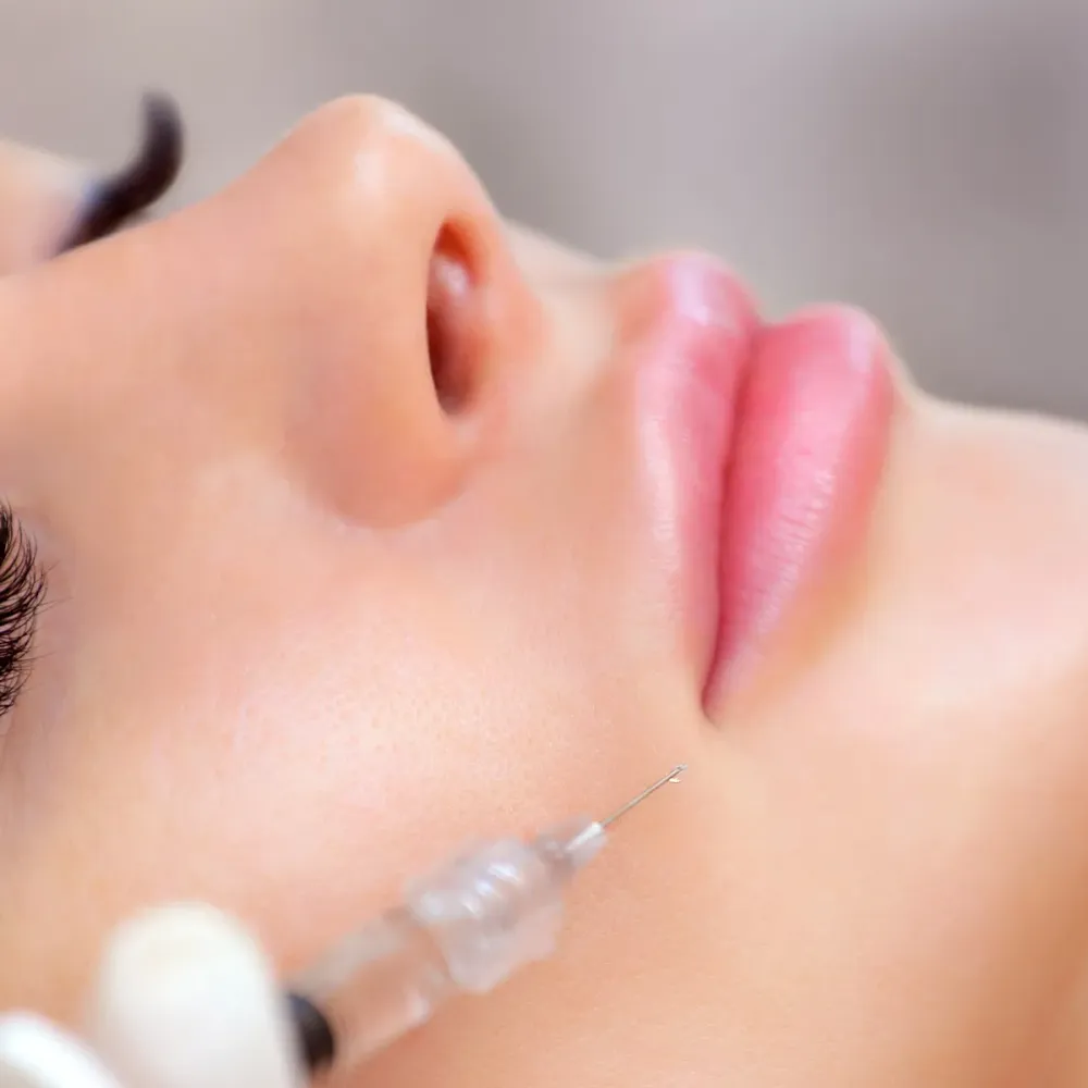 非手术唇型塑造方法？