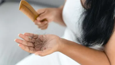 Treatment and Prevention of Hair Loss