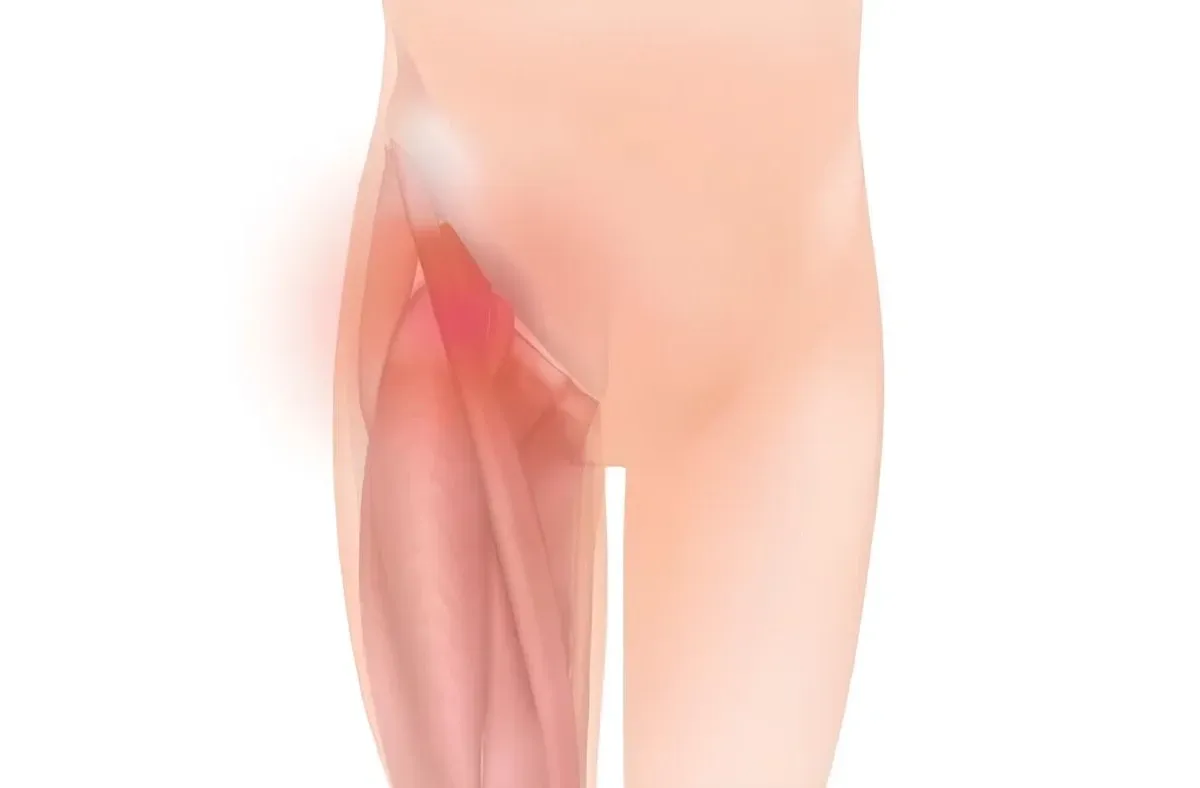 腹部与侧腰手术的风险与并发症